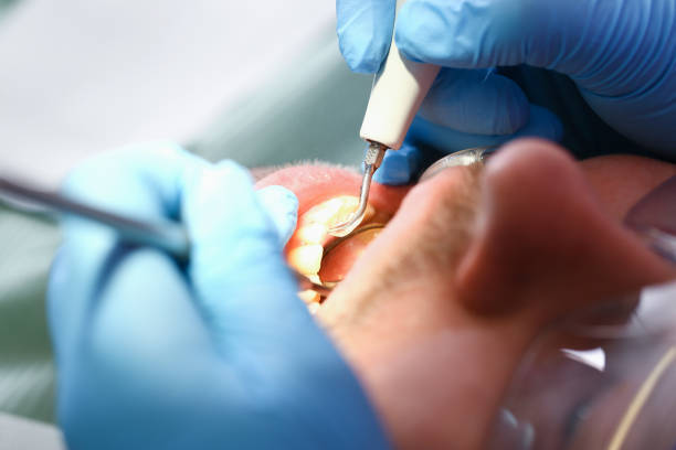 Best After-Hours Emergency Dentist in Laurens, SC
