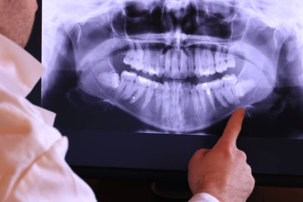 Best Emergency Dental Surgery in Laurens, SC