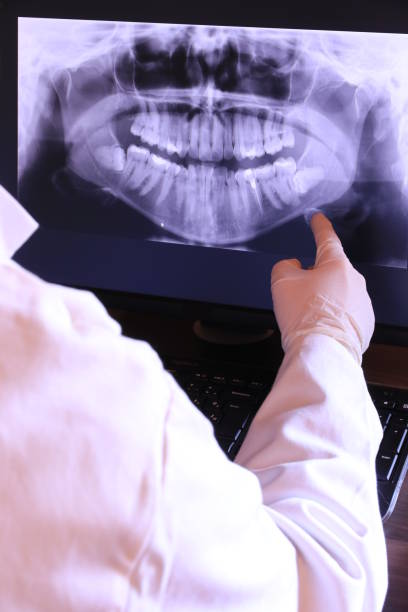 Best Emergency Root Canal Treatment in Laurens, SC
