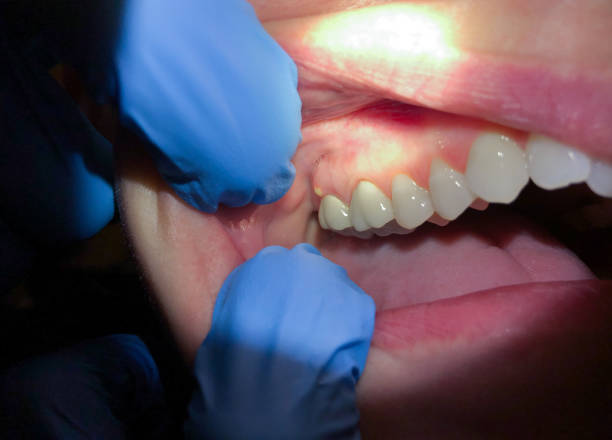 Best Emergency Dental Surgery in Laurens, SC