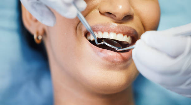 Best Walk-In Emergency Dentist in Laurens, SC